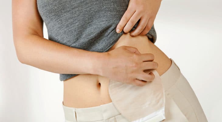 curso de ostomia